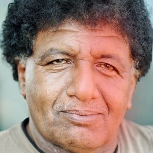 Fisioterapi Bell's Palsy