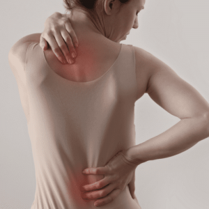 Myofascial Pain Syndrome