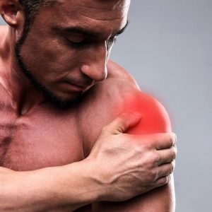 Thoracic Outlet Syndrome (TOS)