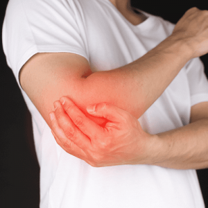 Pronator Teres Syndrome