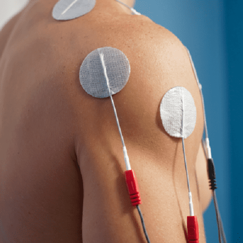 Transcutaneous Electrical Nerve Stimulation (TENS)