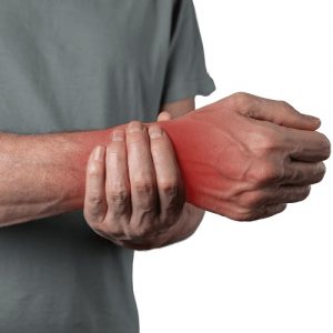 Fisioterapi Fraktur Colles