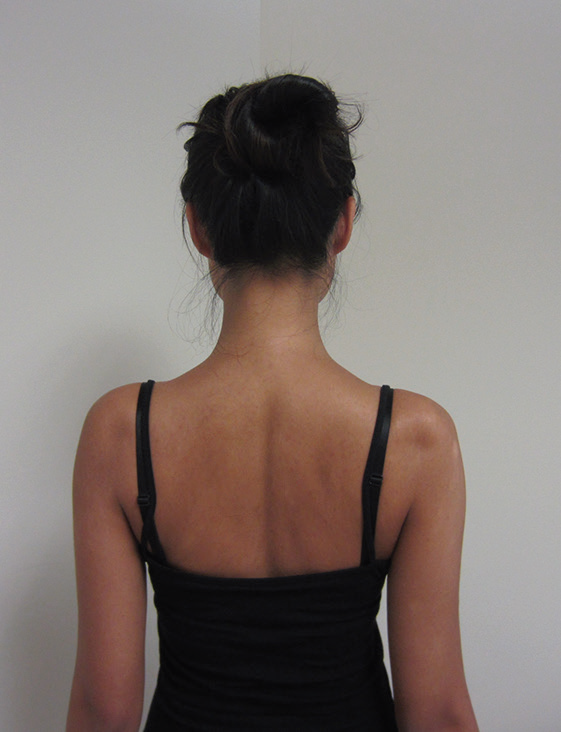 5. Scapular retraction exercise