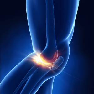 Mengenal cedera meniscus