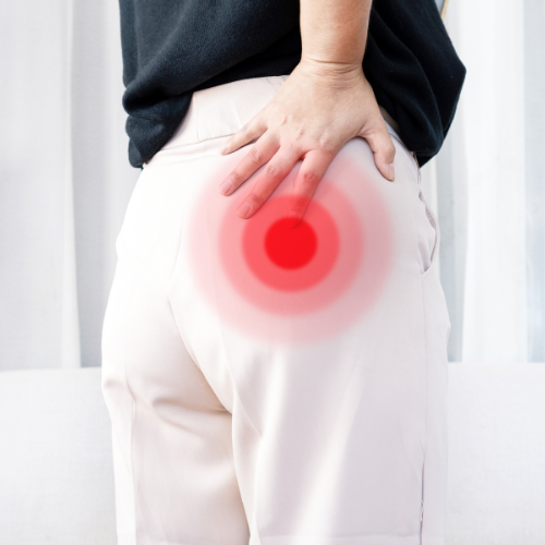 piriformis syndrome